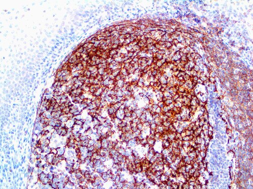 IHC of CD35 on an FFPE Tonsil Tissue